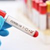 В Германии за сутки выявили 1147 случаев коронавируса - Фото