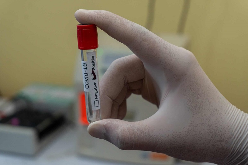 В Россия выявили 8135 новых случаев коронавируса - Фото