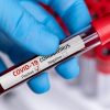 Ученые: у пациентов с COVID-19 обнаружили повышение уровня сахара в крови - Фото