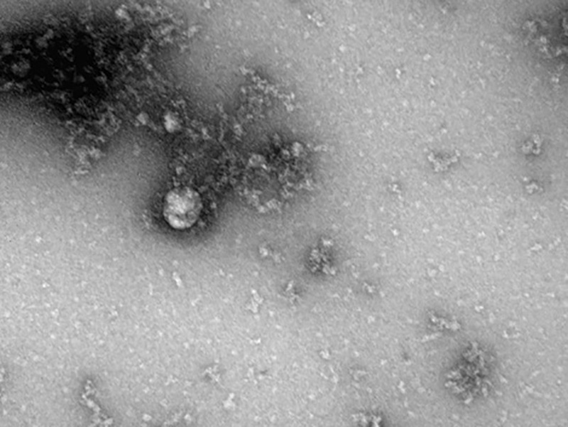 Российские учёные сделали первое фото британского штамма SARS-CoV-2 - Фото