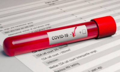 Минздрав РФ назвал сроки сохранения иммунитета у переболевших COVID-19 - Фото