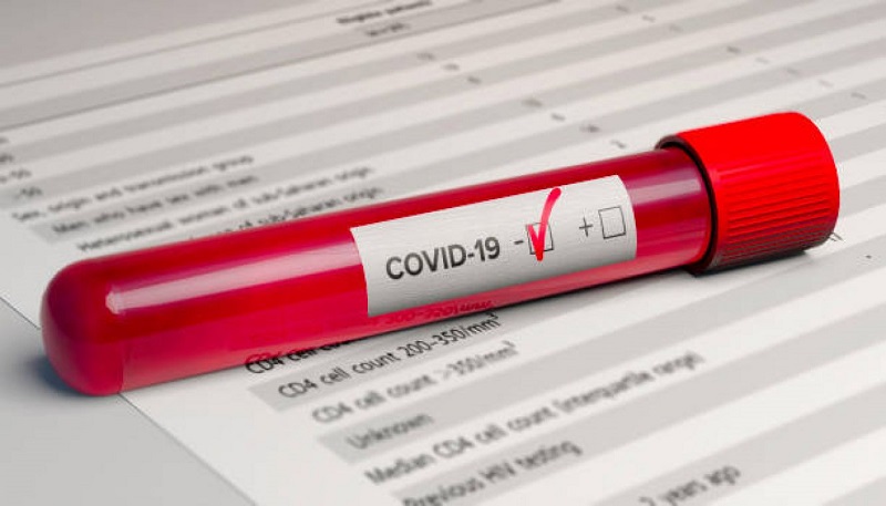 Минздрав РФ назвал сроки сохранения иммунитета у переболевших COVID-19 - Фото
