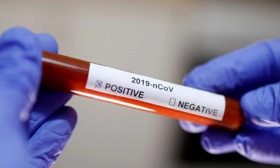 Новый штамм коронавируса SARS-CoV-2 обнаружили в 22 странах Европы - Фото