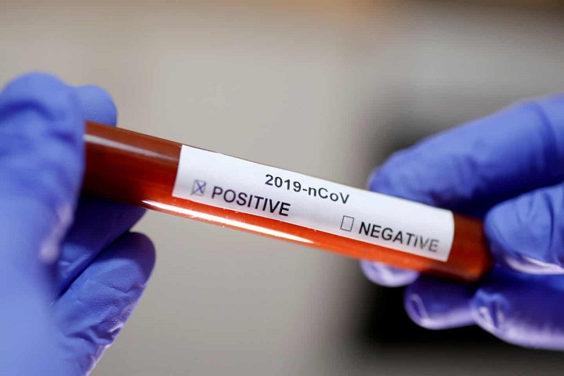 Новый штамм коронавируса SARS-CoV-2 обнаружили в 22 странах Европы - Фото