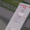 В России разработают тесты для более быстрого мониторинга коронавируса COVID-19 - Фото