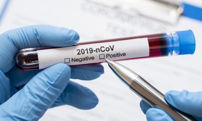 В Испании задержали мужчину, заразившего коронавирусом COVID-19 более 20 человек - Фото