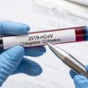 ВОЗ заявила о росте случаев коронавируса COVID-19 в мире 7-ю неделю подряд - Фото