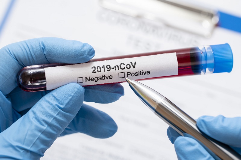 ВОЗ заявила о росте случаев коронавируса COVID-19 в мире 7-ю неделю подряд - Фото